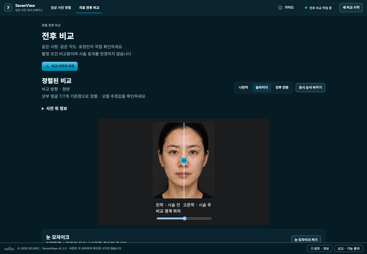 합성 사진으로 슬라이더 비교 기능을 보여주는 실제 Community 화면